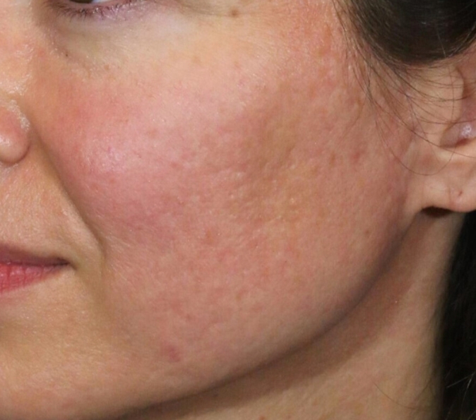 Before image