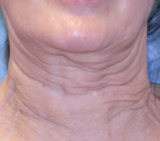 Before image
