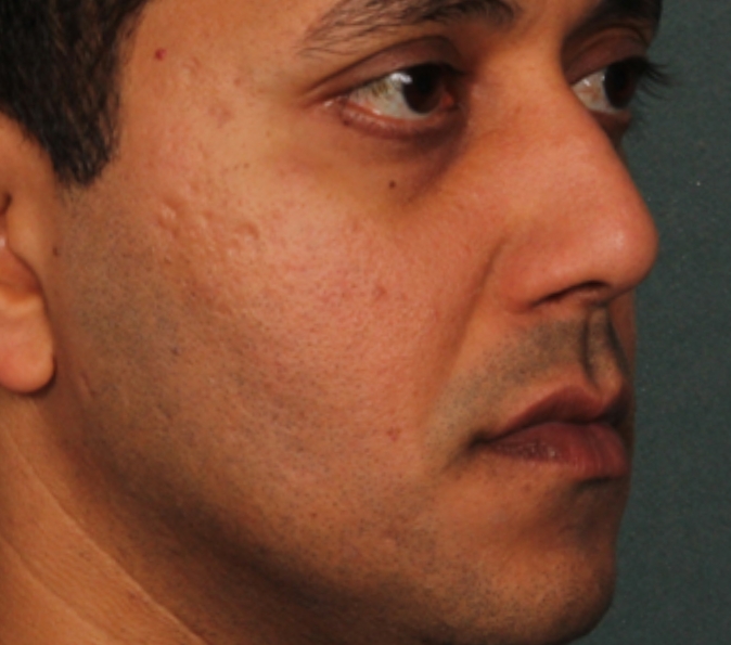 After image